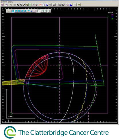 figure3cyclotron